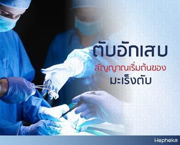 ัตับอักเสบ