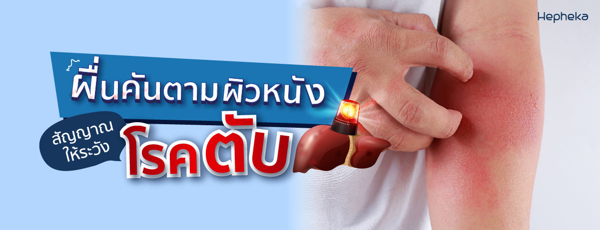 คันตามผิวหนัง สัญญาณให้ระวังโรคตับ