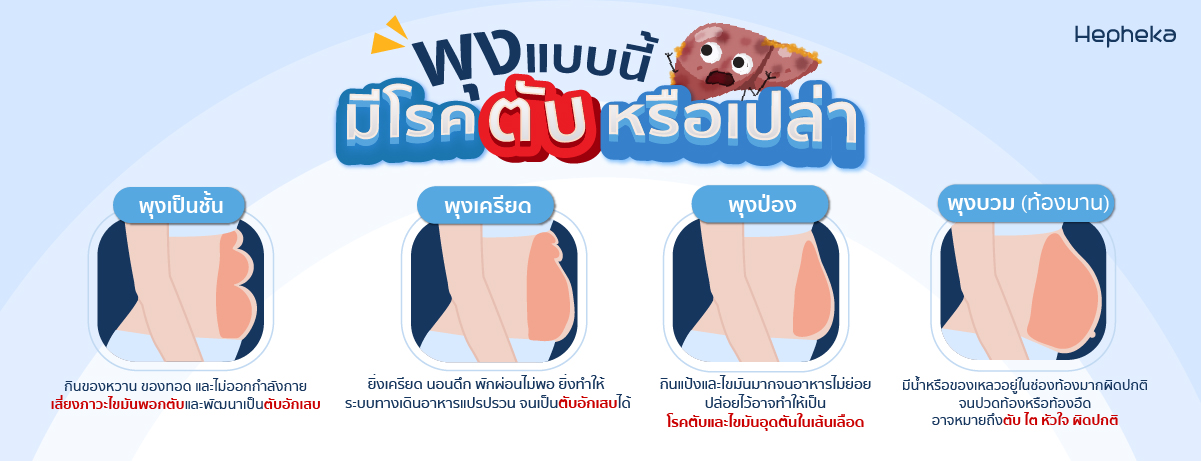 พุงใหญ่ แบบนี้ มีโรคตับหรือเปล่า