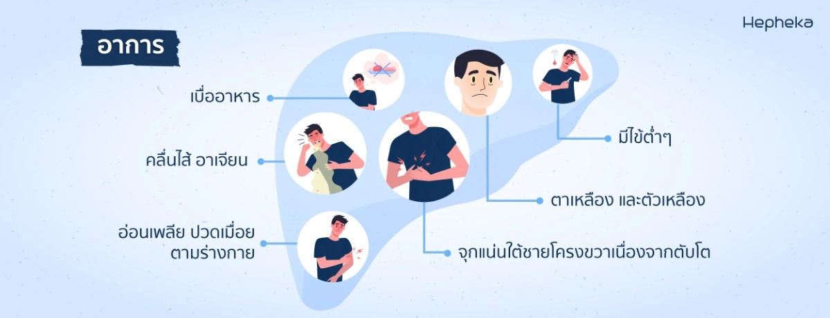 2022 0219 ไวรัสตับอักเสบบี โรคร้ายที่กลายเป็นมะเร็งตับ BN02