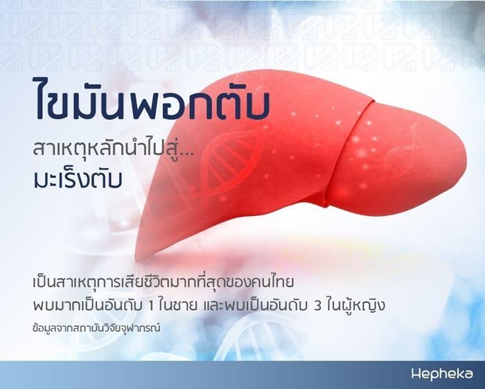 โรคไขมันพอกตับ สาเหตุหลักนำไปสู่ มะเร็งตับ