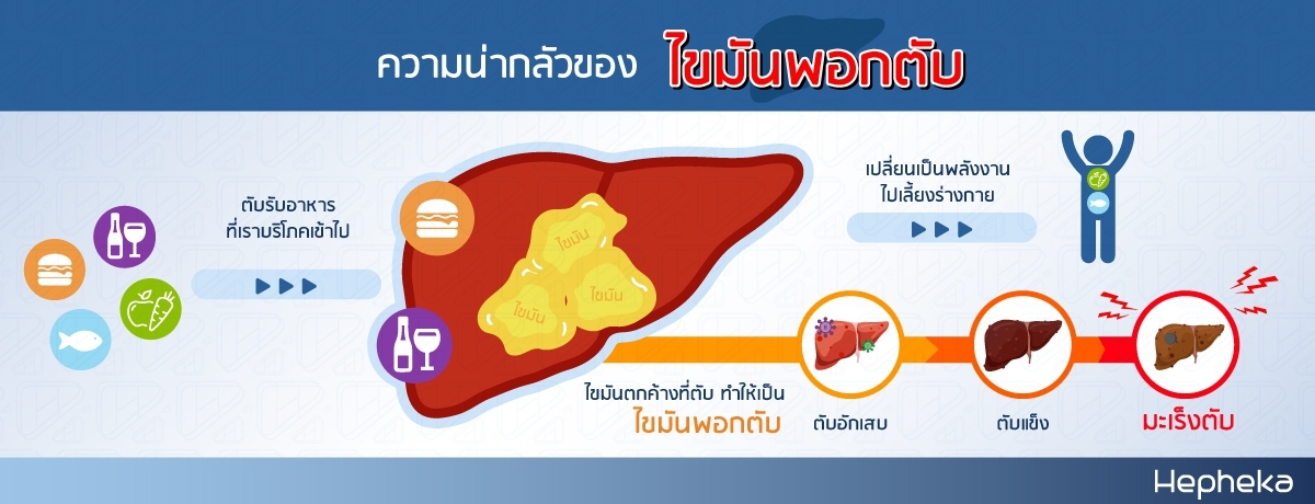 ความน่ากลัวของ ไขมันพอกตับ