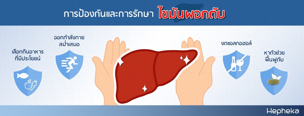 การป้องกันและการรักษา ไขมันพอกตับ