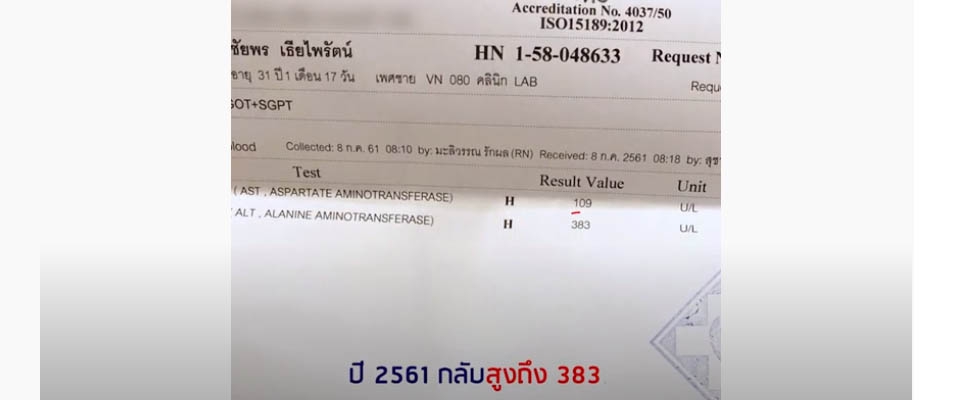 ค่าตับ