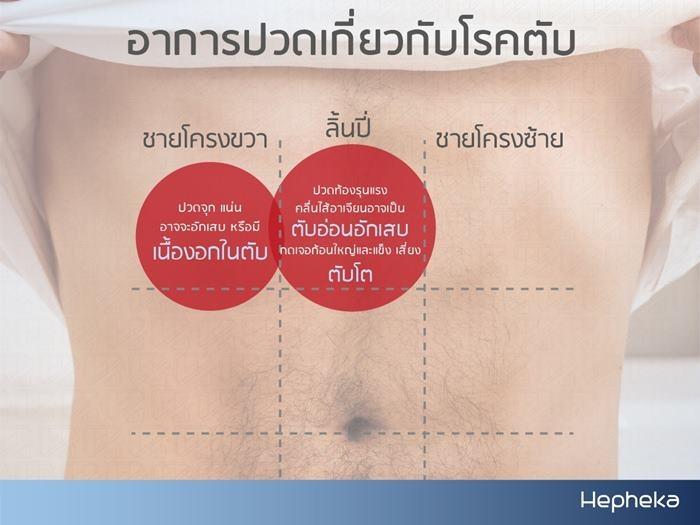 อาการ ปวดชายโครงขวา เกี่ยวกับโรคตับ