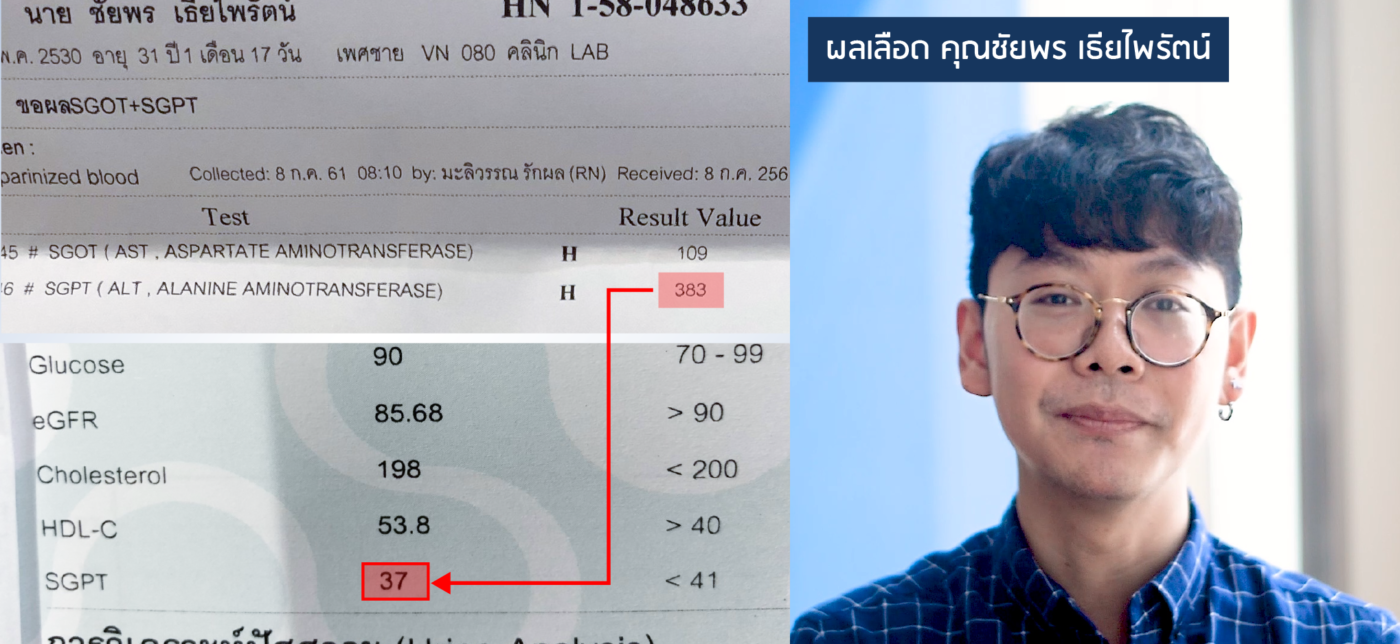 ค่าตับอักเสบ ที่สูงถึง 383 ลดลงเหลือ 37