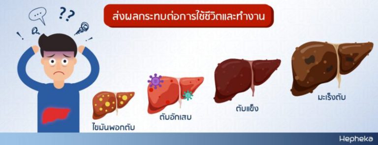 ความรุนแรงของอาการ อ่อนเพลีย ที่เกิดจากสุขภาพตับไม่ดี