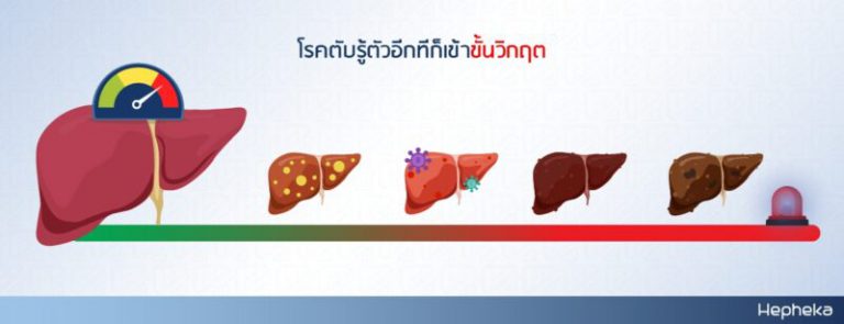 ระยะเวลาตับพัง ทำให้ อ่อนเพลีย
