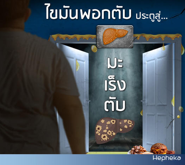 ไขมันพอกตับภัยเงียบ ประตูสู่ มะเร็งตับ