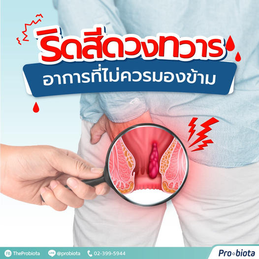ริดสีดวง