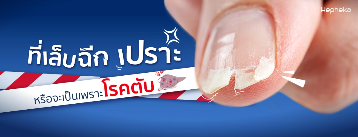 เล็บฉีก