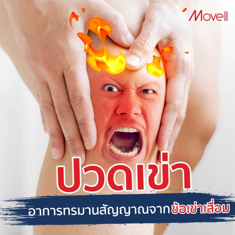 2023 171 ปวดเข่า อาการทรมานสัญญาณจากข้อเข่าเสื่อม 0
