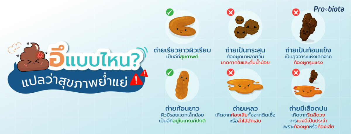 อึแบบไหน แปลว่าสุขภาพย่ำแย่
