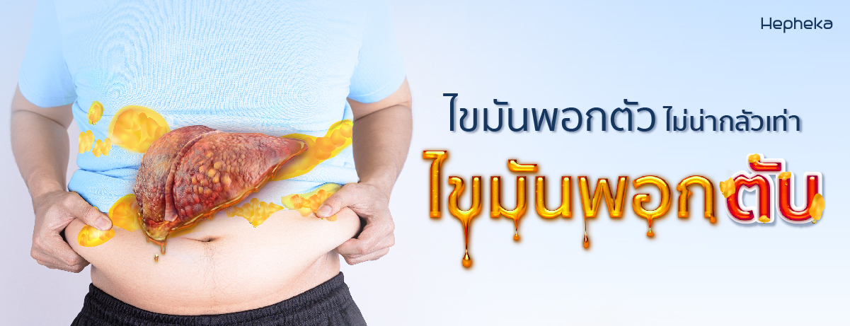 ไขมันหน้าท้อง ยังไม่น่าร้อนใจเท่าไขมันพอกตับ