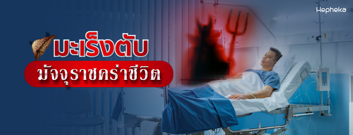 สัญญาณมะเร็งตับ มัจจุราจคร่าชีวิต