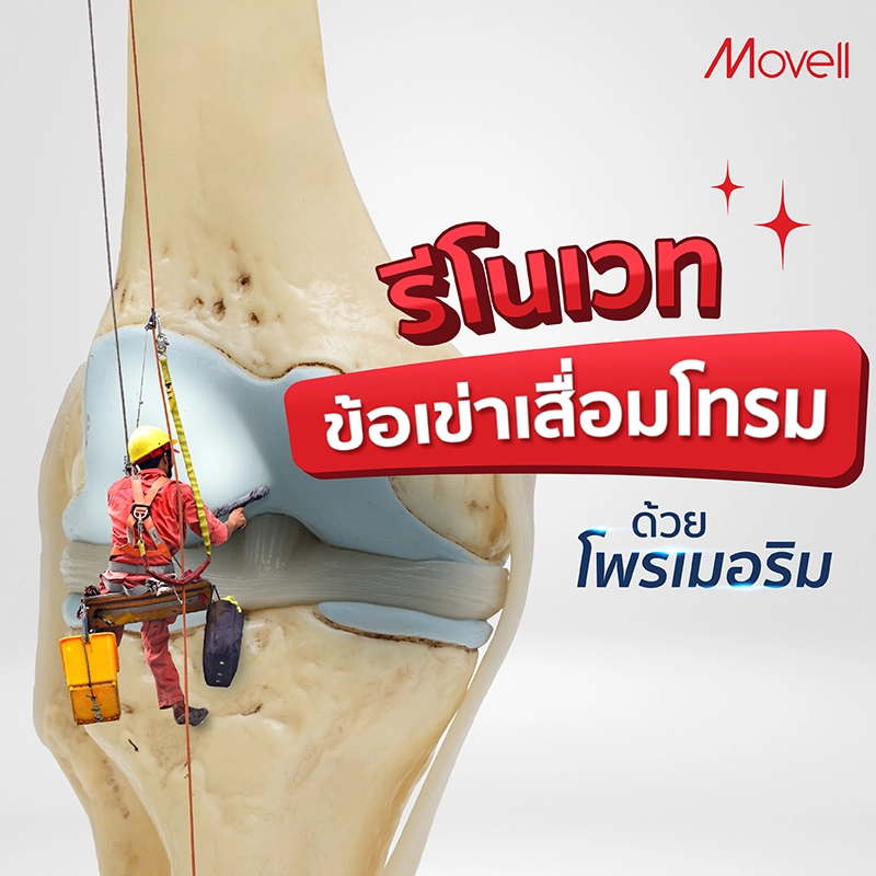 เข่าพัง รีโนเวทได้ด้วย โพรเมอริม
