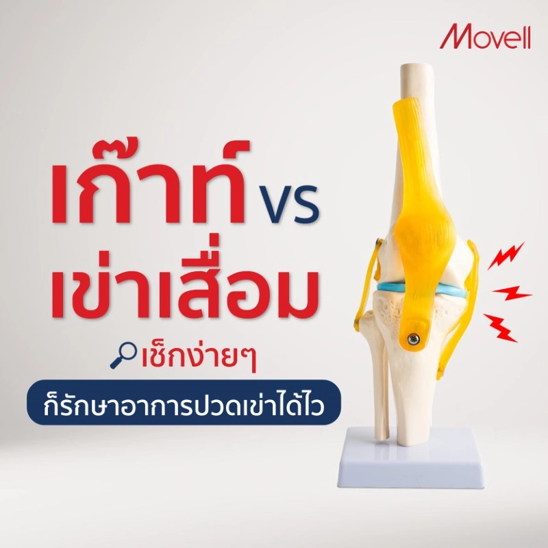 เก๊าท์ VS เข่าเสื่อม เช็กง่ายๆ ก็รักษาอาการปวดเข่าได้ไว