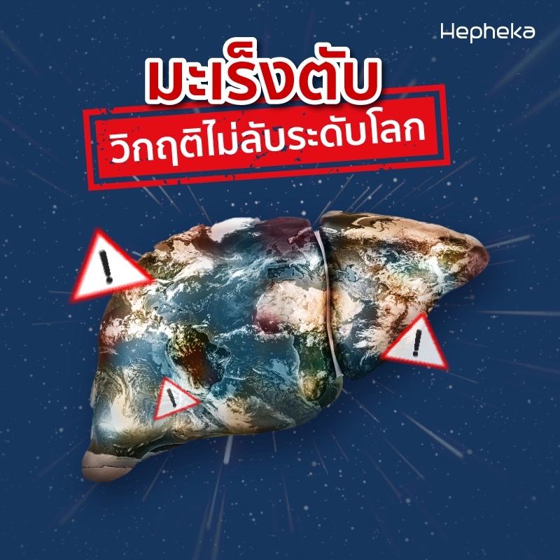 ภัยเงียบ มะเร็งตับวิกฤติไม่ลับระดับโลก