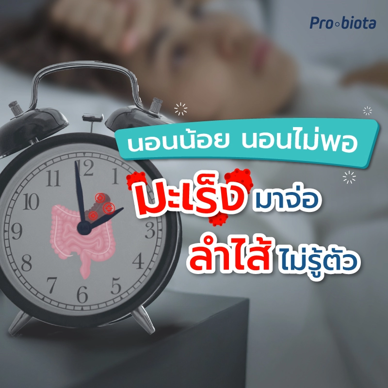 พักผ่อนน้อย นอนไม่พอมะเร็งลำไส้มาต่อไม่รุ้ตัว