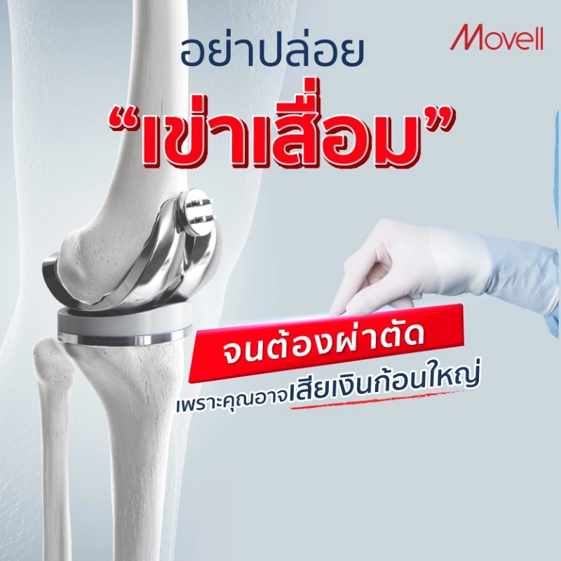 ต้องผ่าตัด เสียเงินก้อนใหญ่เพราะปล่อยให้เข่าเสื่อม