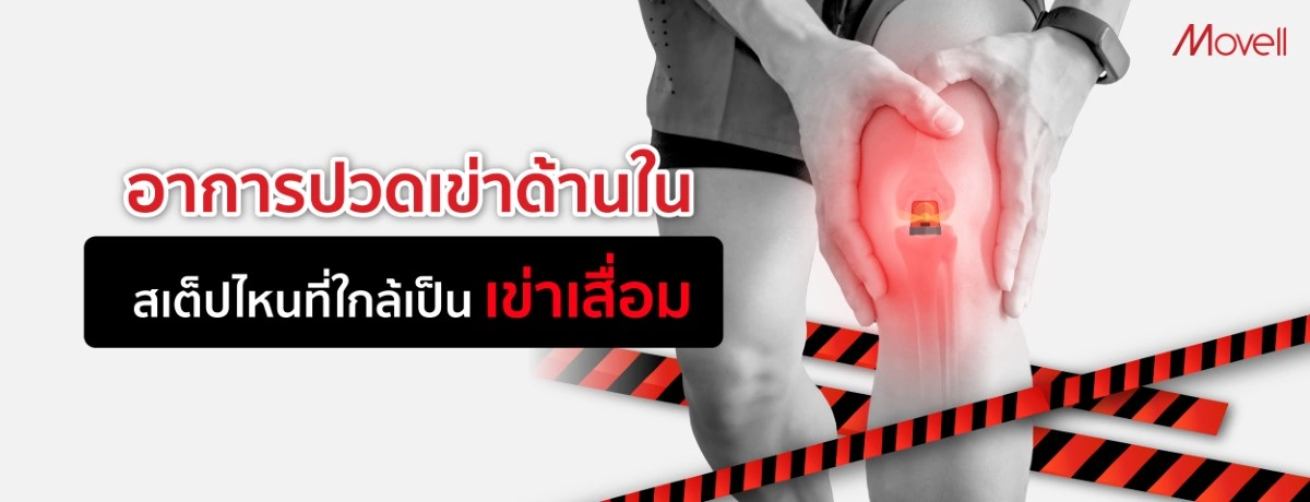 อาการปวดเข่าด้านใน สเต็ปไหนที่ใกล้เป็นเข่าเสื่อม