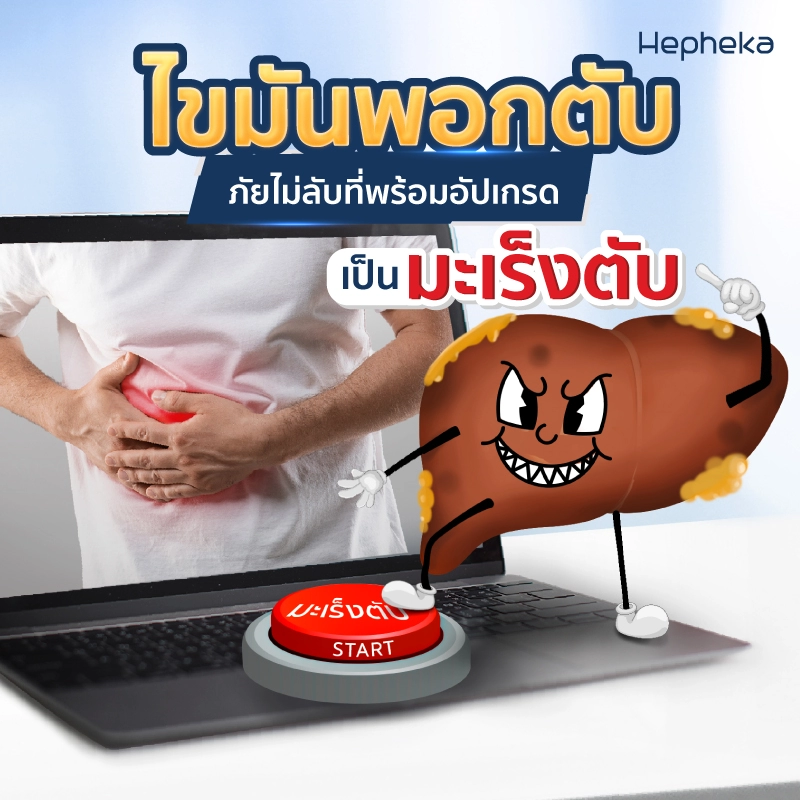 เสี่ยงชีวิต พัง เพราะไม่ทันระวังไขมันพอกตับ
