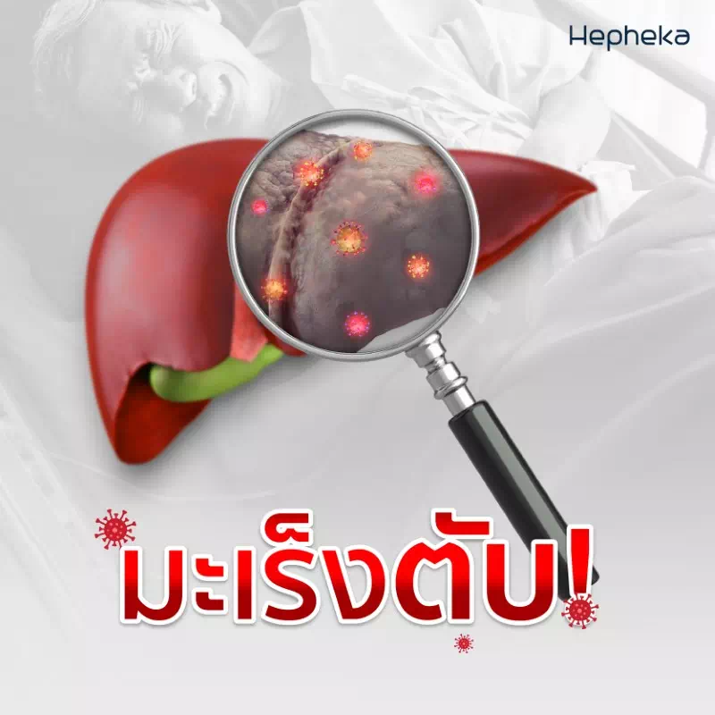 มะเร็งตับ คืออะไร