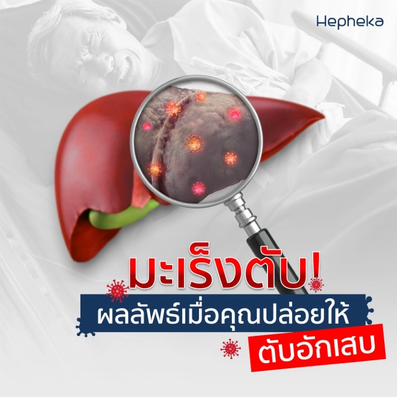 มะเร็งตับ ผลลัพธ์เมื่อคุณปล่อยให้ ตับอักเสบ