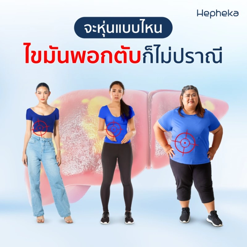 จะหุ่นแบบไหน Skinny Fat