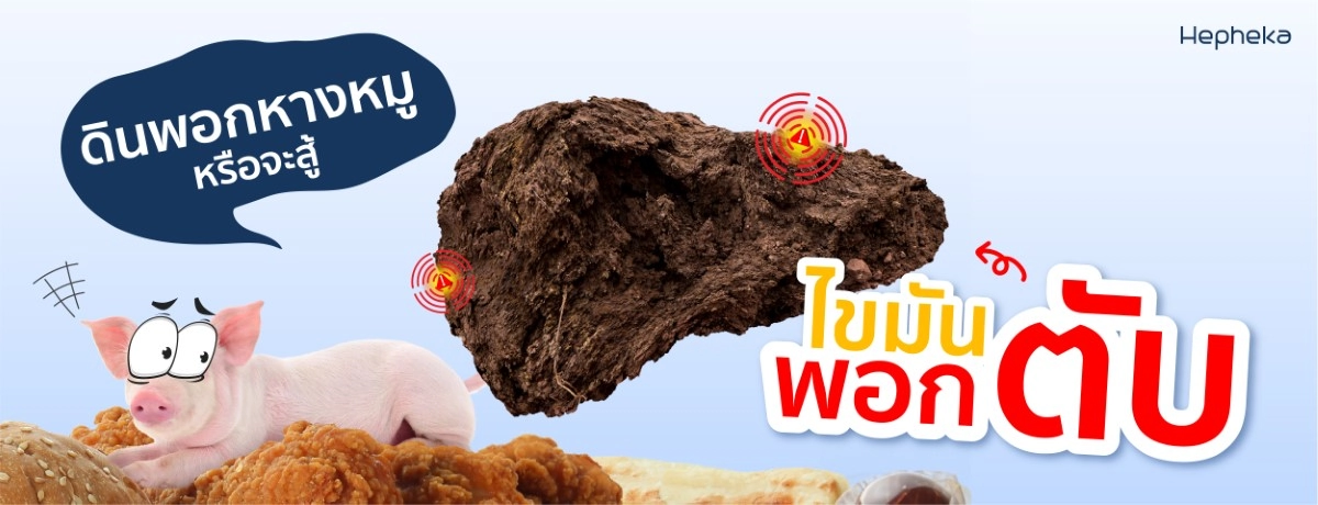 ไขมันเกาะตับ