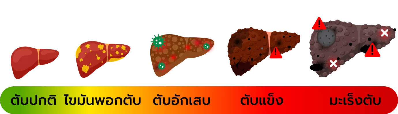 อาหารที่ควรระวัง
