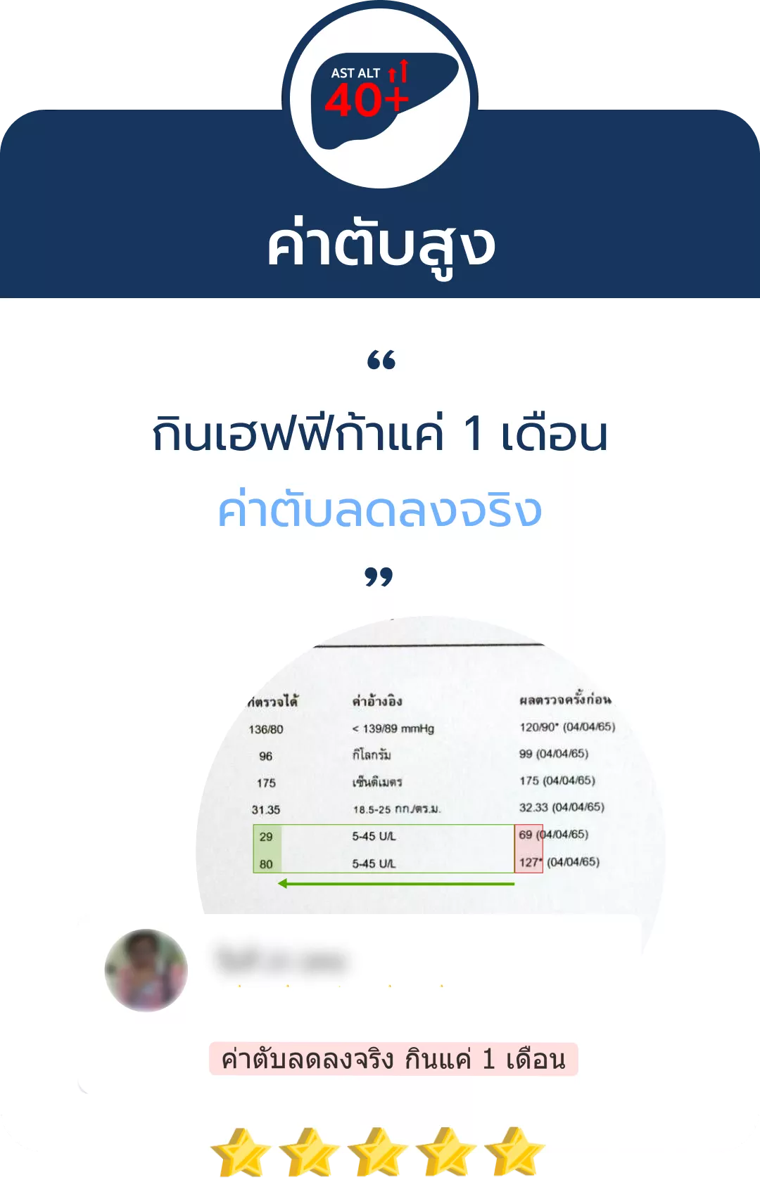 การันตี 5